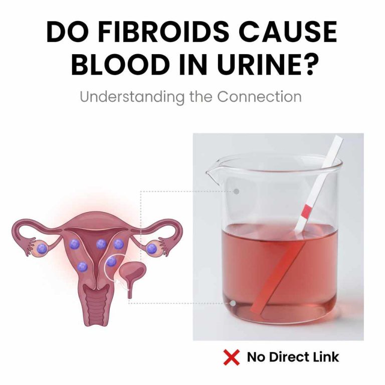 Do Fibroids Cause Blood In Urine?